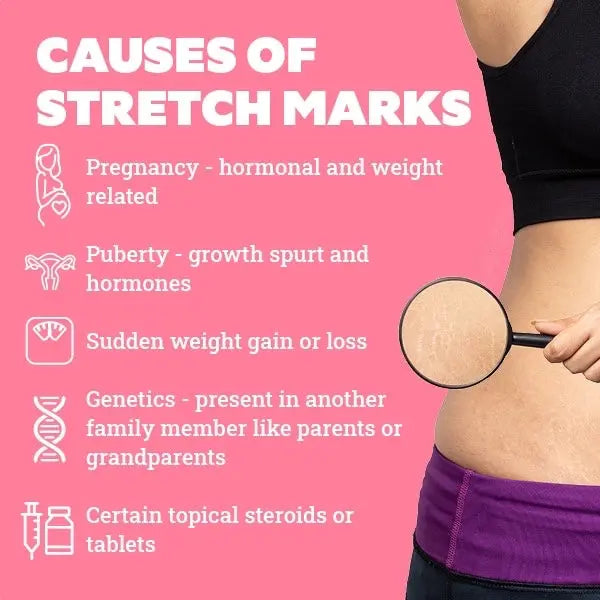 Stretch Marks Cream 16. Oz Bonita Shape