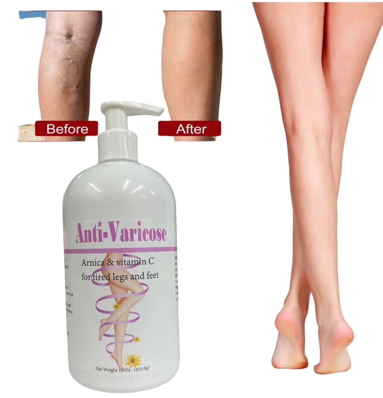 ANTI-VARICOX LOTION - Bonita Shape