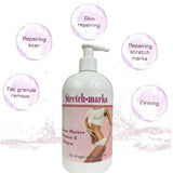 Stretch Marks Cream 16. Oz